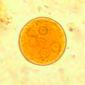 Kyste d'Entamoeba coli coloré au lugol