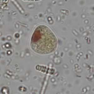 Iodamoeba buschlii cyst stained with Lugol